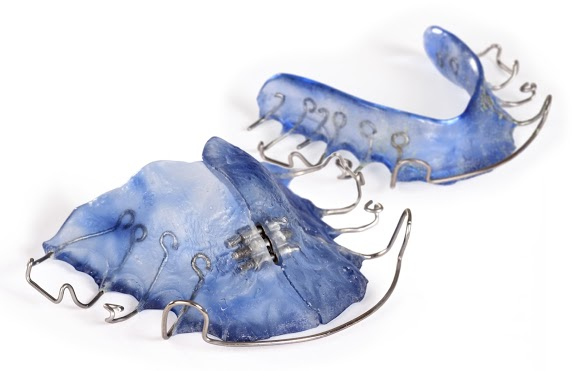 This is the image for the news article titled Don't Forget Your Retainer