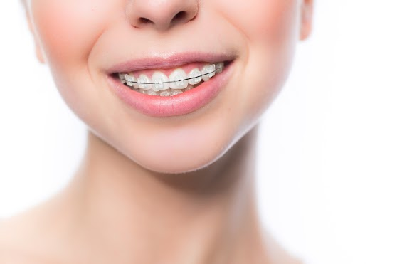 What is Orthodontic Wax?